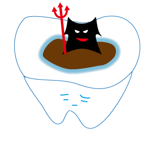 虫歯の図１