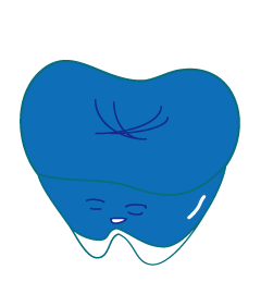 虫歯の図４