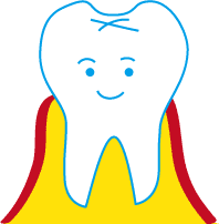 歯周病の図１
