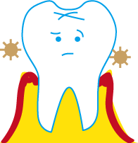 歯周病の図２