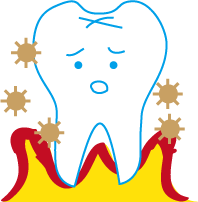 歯周病の図３