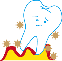 歯周病の図４